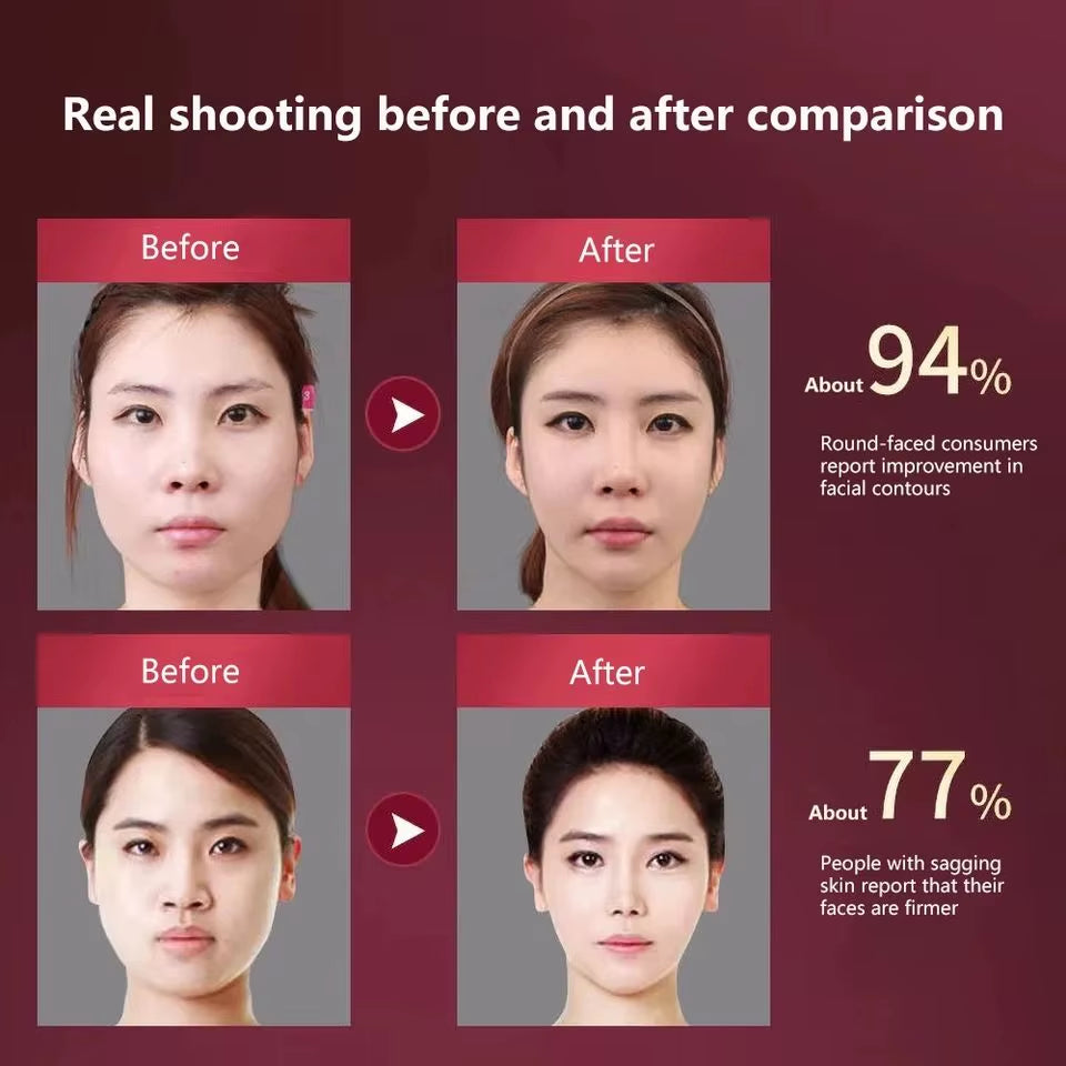 Face Lifting Device LED Photon Therapy Vibration Facial Massager Face Slimming Double Chin Removal V Line Lift Belt Skin Care